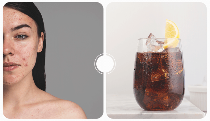 From Acne To Weight Gain 6 Reasons To Quit Drinking Carbonated Water